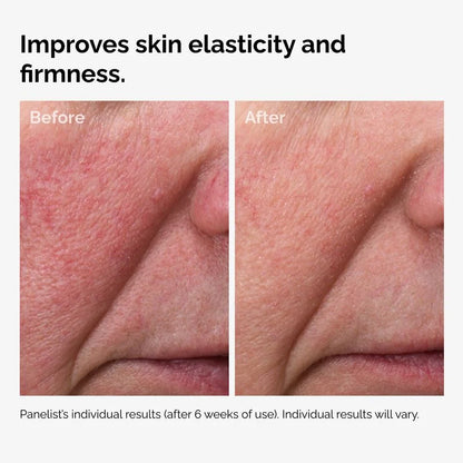 100% Fermented Rose Hip Seed Oil