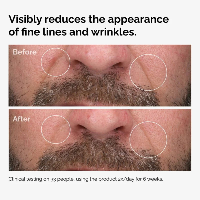 100% Fermented Rose Hip Seed Oil