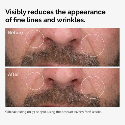 100% Fermented Rose Hip Seed Oil