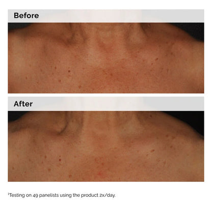 Niacinamide 5% Face and Body Emulsion